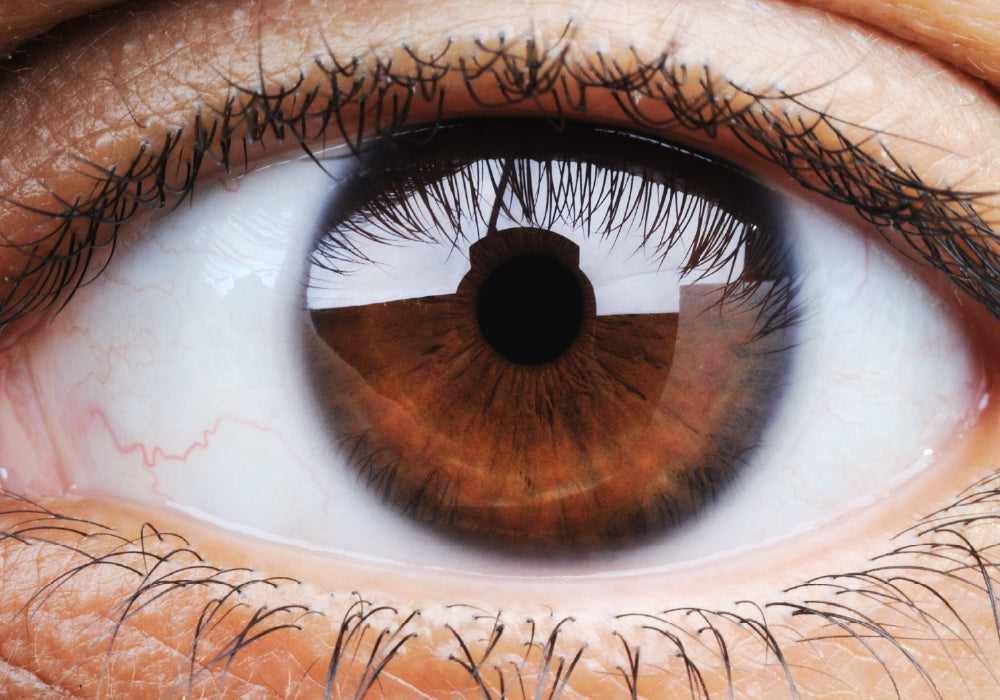 Meibomian Gland Dysfunction: The Quiet Cause of Most Dry Eye